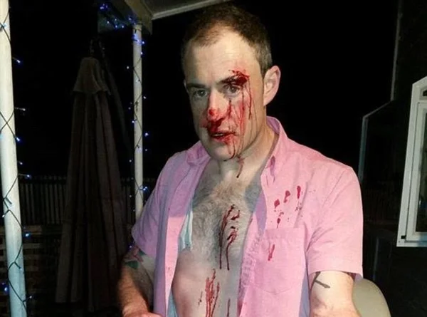 Homem heterossexual é agredido por usar camisa cor de rosa