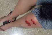 Mulher salta de carro em movimento para escapar do ex agressor
