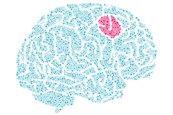 Ilustração de tumor cerebral - Neurologista explica sintomas comuns que podem indicar tumor cerebral - Metrópoles