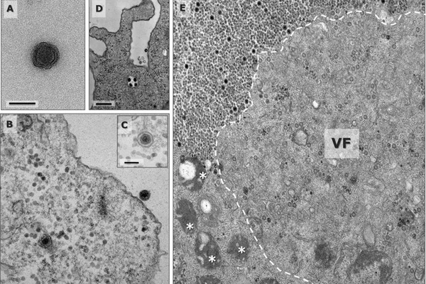 Cientistas brasileiros descobrem vírus com 90% de genes inéditos