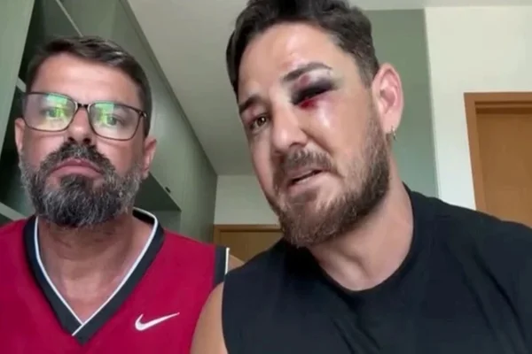 Imagem colorida, turista diz que violência foi maior por homofobia- Metrópoles
