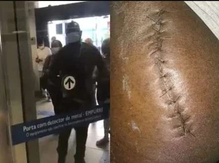 Após ser barrado 5 vezes, homem com prótese abaixa calça para entrar em banco