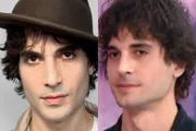 Compare antes e depois da harmonização facial de Fiuk