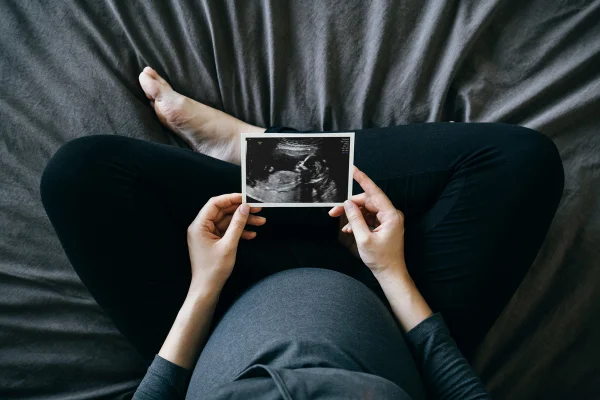 Foto de alto ângulo de uma mulher grávida segurando uma foto de ultrassom na frente de sua barriga, sentada na cama em casa. Maternidade - Metrópoles
