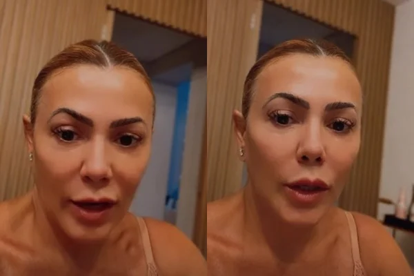 Ex-BBB revela diagnóstico de cisto no cérebro: “Entrei em pânico”