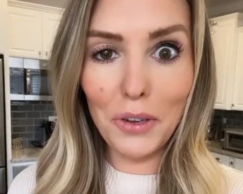 Influencer fica com olho arregalado após reação inesperada ao botox