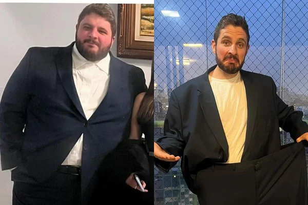 Ex-Masterchef impressiona ao perder 83kg; veja antes e depois