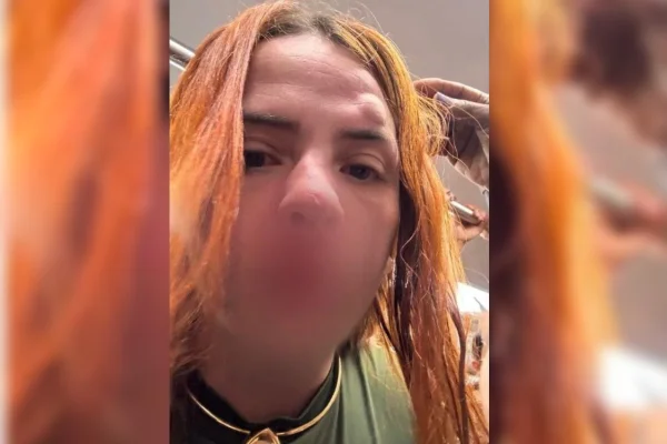 Foto colorida de mulher vítima de agressão durante briga no metrô do Rio de Janeiro