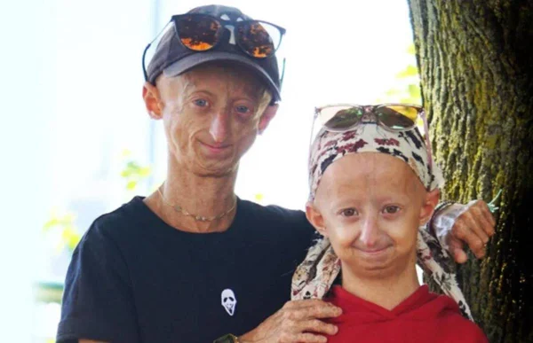 EUA aprova primeiro medicamento para tratar a doença progeria