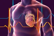 O infarto do miocárdio acontece quando o fluxo sanguíneo no músculo miocárdio é interrompido por longo período. A ausência do sangue na região pode causar sérios problemas e até a morte do tecido. Obesidade, cigarro, colesterol alto e tendência genética podem causar a doença. Entre os sintomas estão: dor no peito que dura 20 minutos, formigamento no braço, queimação no peito, etc.