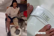 Gracyanne Barbosa mostra peso depois da internação