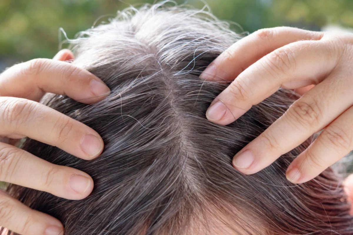 O cabelo branco surge devido à diminuição ou perda da produção de melanina, o pigmento que dá cor aos fios O cabelo branco surge devido à diminuição ou perda da produção de melanina, o pigmento que dá cor aos fios