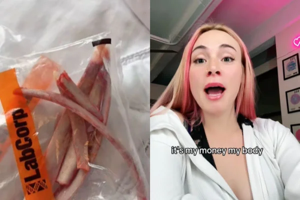 Foto colorida de ossos e uma mulher falando - Metrópoles