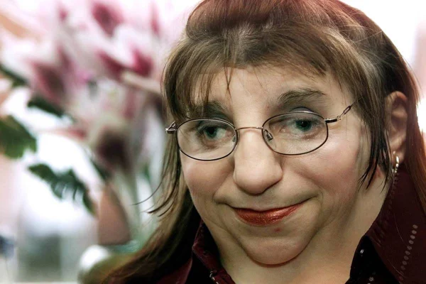 Foto de uma mulher de óculos branca com orelhas à mostra