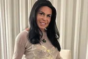Transplante de Gretchen por alopecia: médicos explicam queda de cabelo Transplante de Gretchen por alopecia: médicos explicam queda de cabelo