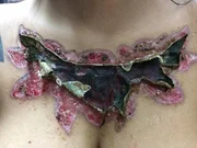 Garota relata momentos de dor ao remover tatuagem com método polêmico - imagem 6 Garota relata momentos de dor ao remover tatuagem com método polêmico - imagem 6