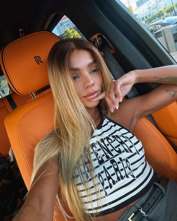Brunna Gonçalves faz cirurgia plástica para diminuir tamanho da testa