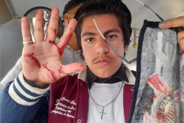 vitor estudante agredido bolsonarista jundiai sao paulo