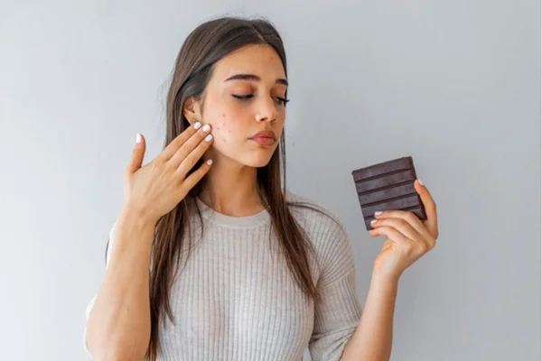 Menina jovem com espinhas no rosto passando a mão, segurandoo uma barra de chocolate na outra - Metrópoles