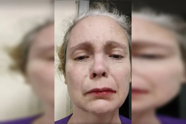 Imagem colorida de Sandra Bouyer, médica agredida durante plantão no Rio