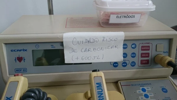 Cuidado! No Posto de Saúde do Núcleo Bandeirante, desfibrilador tem “risco de carbonizar”