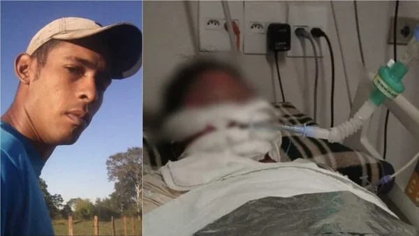 MS: mulher acorda do coma, conta que marido ateou fogo nela e morre