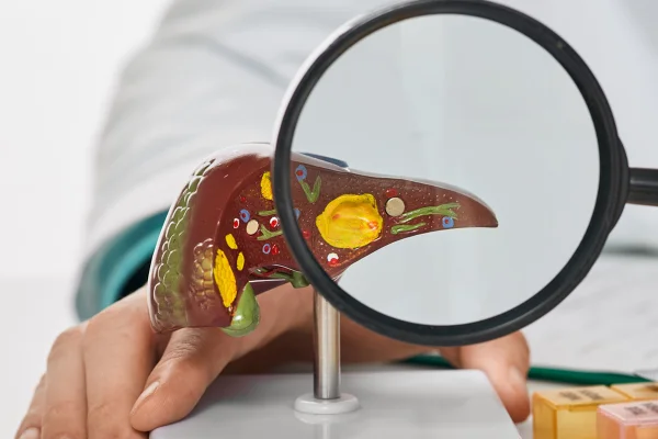 Entenda a relação entre a proteína e o acúmulo de gordura no fígado