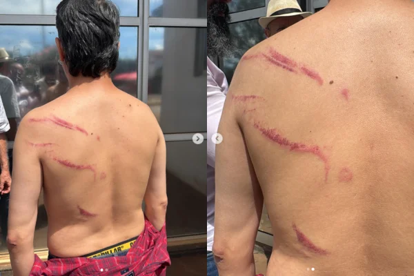Imagem colorida, Vereador do PT preso em ato do MST acusa polícia de agressão física - Metrópoles