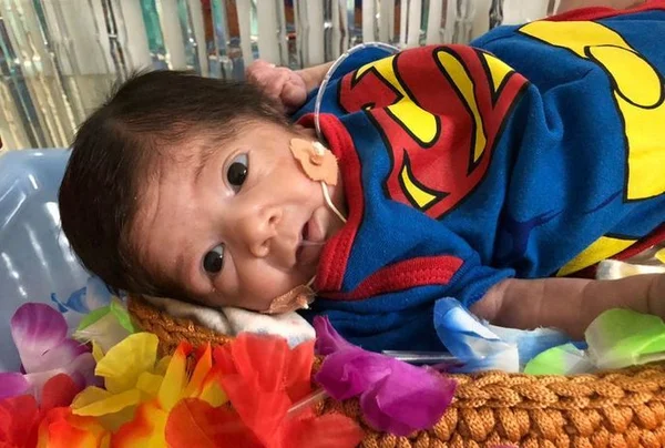 Bebês internados em UTI ganham ensaio fotográfico de Carnaval na PB