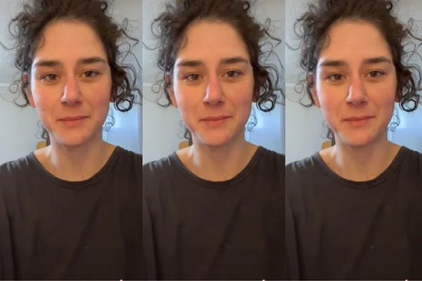 Shampoo anticaspa no rosto? Expert fala sobre o truque viral do TikTok