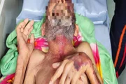 Resgate de homem, de 69 anos, ocorreu nesta quinta Resgate de homem, de 69 anos, ocorreu nesta quinta