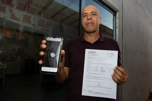 Caso raríssimo: homem com câncer de mama luta por auxílio-doença no DF