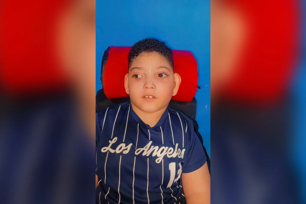 Arthur precisou passar por cirurgia onde foi necessário colocar dois pinos entre o joelho e a coxa Arthur precisou passar por cirurgia onde foi necessário colocar dois pinos entre o joelho e a coxa