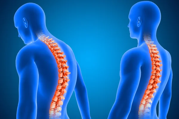 Ilustração colorida que simula imagem infra-vermelha do corpo humano com foco na medúla espinhal - Metrópoles.
