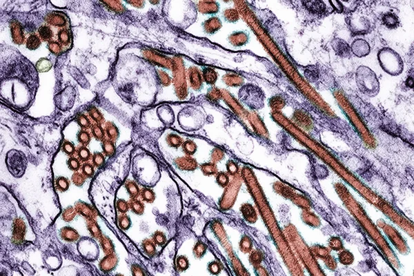 Imagem mostra foto de microscópio do vírus H5N1, da gripe aviária - Metrópoles