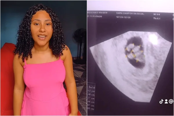 Duas fotos: a primeira de mulher de vestido rosa; a segunda de ultrassonografia de quíntuplos