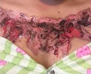 Garota relata momentos de dor ao remover tatuagem com método polêmico - imagem 4 Garota relata momentos de dor ao remover tatuagem com método polêmico - imagem 4