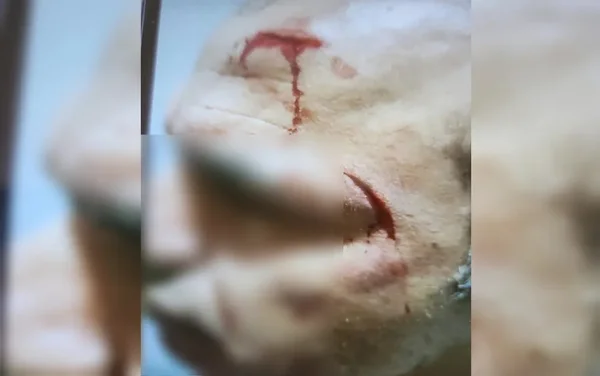 goias homem agredido com enxada por vizinho