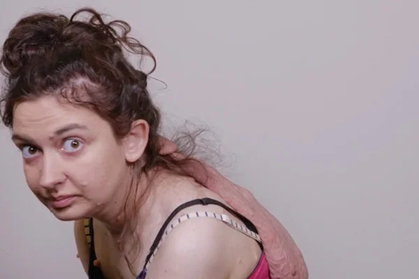 mulher de perfil com tumor no pescoço - Metrópoles