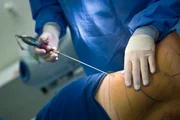 Segurança na cirurgia plástica depende de 7 cuidados fundamentais - imagem 6 Segurança na cirurgia plástica depende de 7 cuidados fundamentais - imagem 6