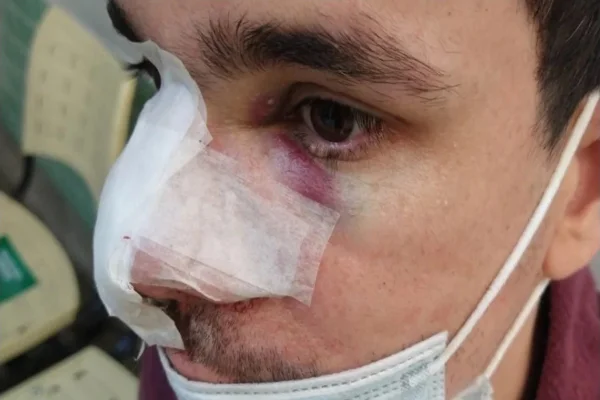 Som alto de igreja gera conflito e jovem com doença rara é agredido