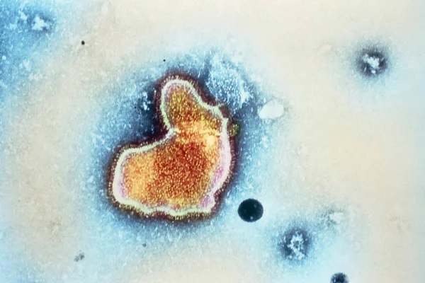 Imagem mostra o vírus sincicial respiratório, que causa bronquiolite em crianças, visto em microscópio - Metrópoles