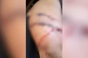 Grávida é atacada com cacos de vidro por namorada do ex-companheiro em GO - imagem 2 Grávida é atacada com cacos de vidro por namorada do ex-companheiro em GO - imagem 2