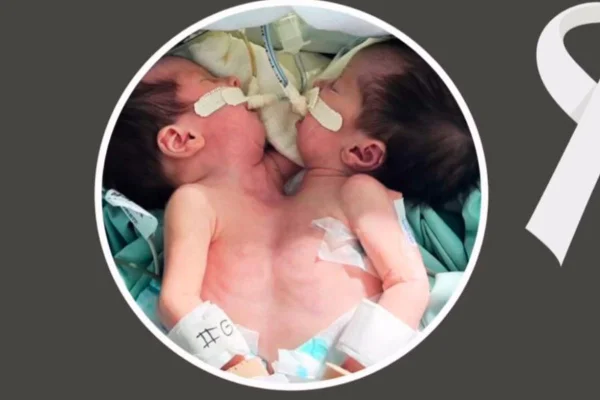 Imagem colorida das irmãs Nathaly e Rhadassa que faleceram - Metrópoles