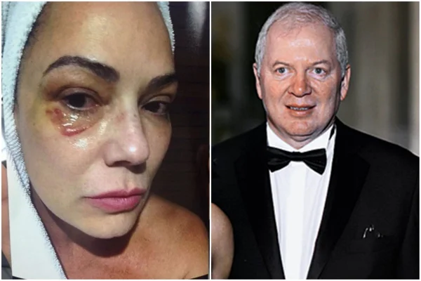 Ex de Luiza Brunet terá que indenizar a modelo por agressão em 2016 1 luiza brunet e ex marido 1