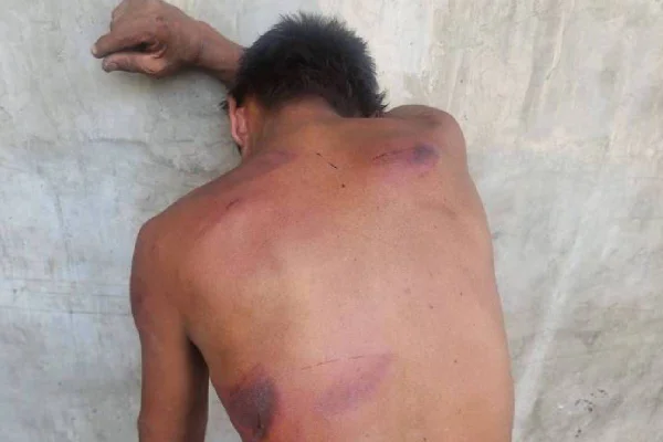 Homem em situação de rua de costas mostra suas feridas após ser agredido com facão na região do Parque do Ibirapuera - Metrópoles