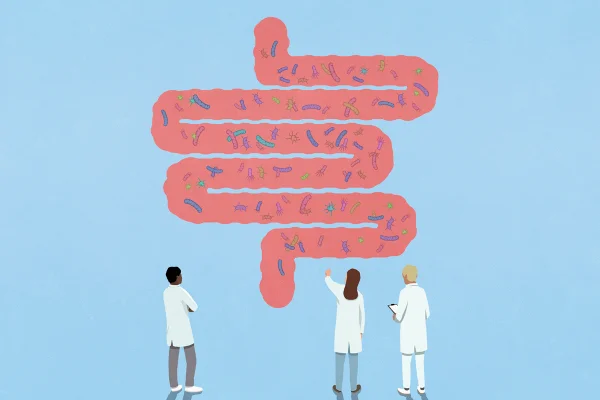 Ilustração coloridade de médicos analisando intestino grosso - Metrópoles.