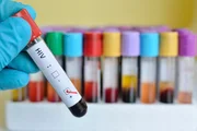 O tratamento é uma combinação de medicamentos que podem variar de acordo com a carga viral, estado geral de saúde da pessoa e atividade profissional, devido aos efeitos colaterais
O tratamento é uma combinação de medicamentos que podem variar de acordo com a carga viral, estado geral de saúde da pessoa e atividade profissional, devido aos efeitos colaterais