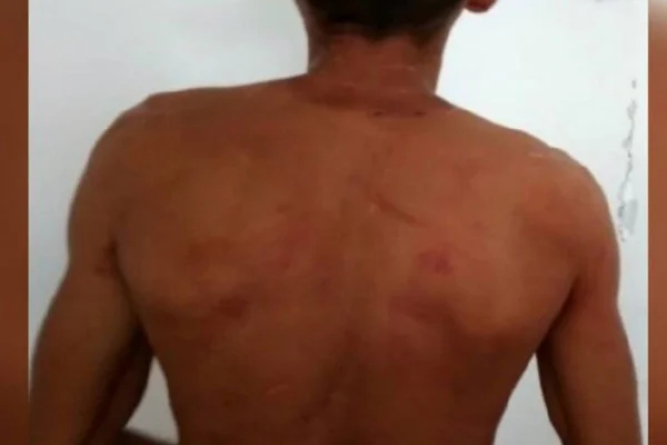 Homem era trancado em casa pela esposa e agredido diariamente