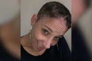 Ana Carolina não tinha histórico familiar de câncer de mama antes de receber o diagnóstico aos 38 anos Ana Carolina não tinha histórico familiar de câncer de mama antes de receber o diagnóstico aos 38 anos